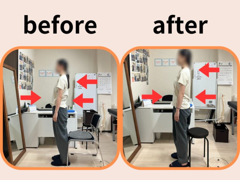 立っている時の姿勢 before・after